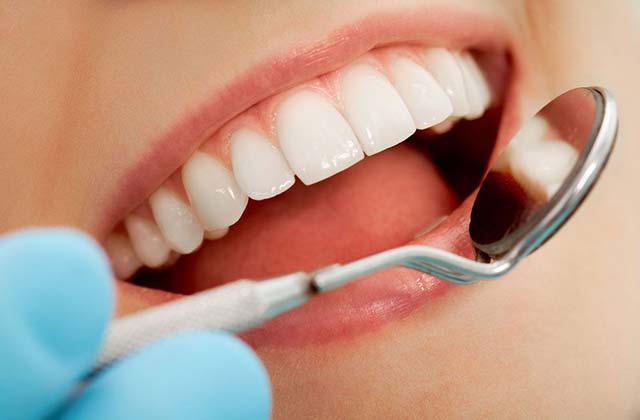 Oral Health - Dental check up